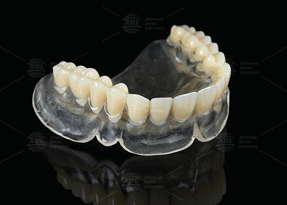 Dentaduras térmicas de curado térmico de vértice para usuarios de dentaduras completas claras