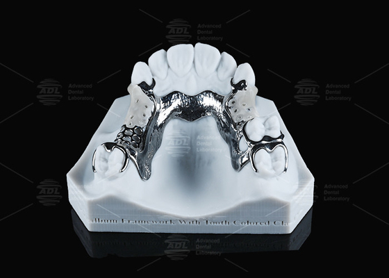FDA Vitallium Framework con clavijas de color de dientes para la estética natural