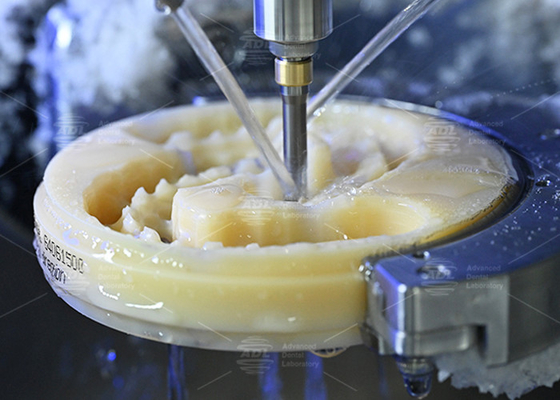 Descubra el poder de la dentadura completa fresada, estéticamente agradable y de aspecto natural para sonrisas perfectas.