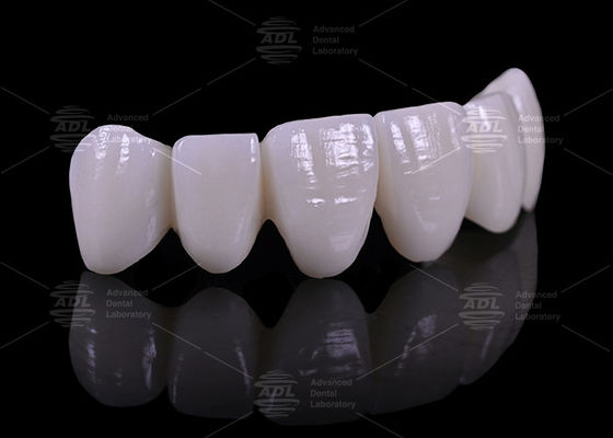 Precios competitivos con descuentos en volumen Laboratorio dental que ofrece 16 tonos de prótesis dental adaptada a la industria médica