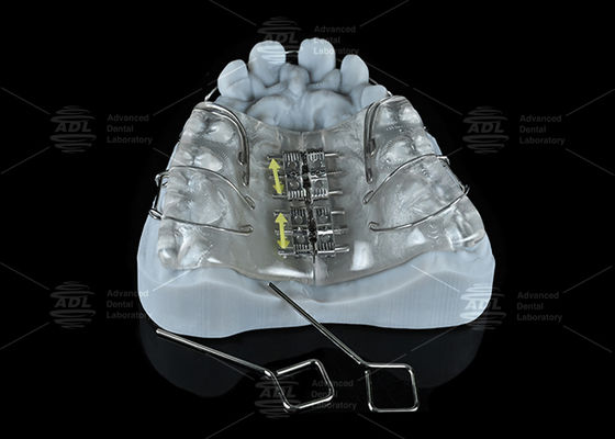 Expansor de tornillo de acero inoxidable de colores para laboratorio dental de China para expansión maxilar y mandibular