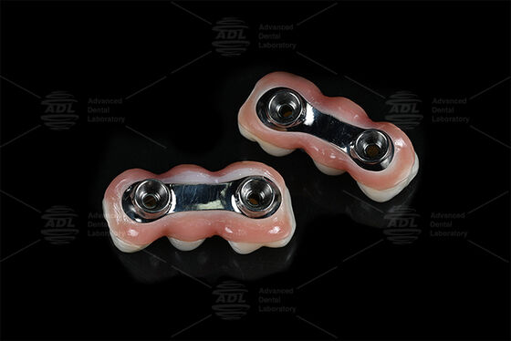 Barra de implante de refuerzo CAD CAM Diseñado para ajuste de precisión Compatible con la mayoría de los sistemas de implantes dentales que aseguran soluciones de restauración dental Laboratorio dental chino