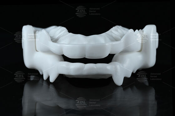 Guardia nocturna de clavija oclusal de nylon de grado médico con diseño CAD/CAM flexible para protección contra el bruxismo